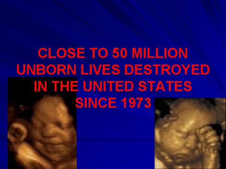 CLOSE TO 50 MILLION UNBORN LIVES DESTROYED IN THE UNITED STATES SINCE 1973 