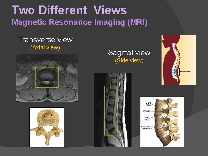 Two Different Views Magnetic Resonance Imaging (MRI) Transverse view (Axial view) Sagittal view (Side