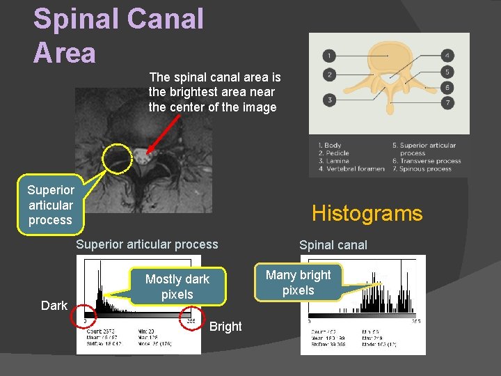 Spinal Canal Area The spinal canal area is the brightest area near the center