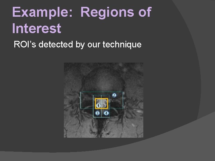 Example: Regions of Interest ROI’s detected by our technique 1 