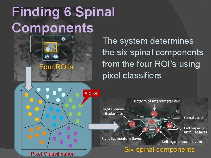 Finding 6 Spinal Components The system determines the six spinal components from the four