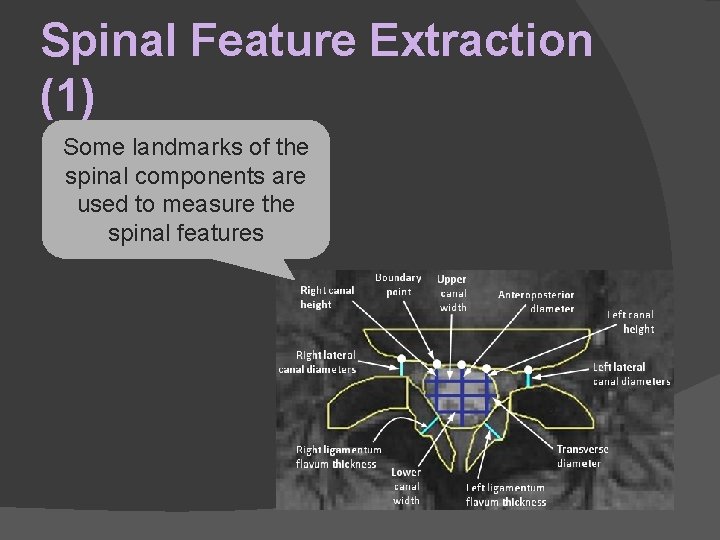 Spinal Feature Extraction (1) Some landmarks of the spinal components are used to measure