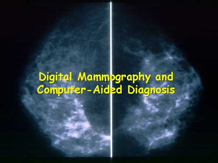 Digital Mammography and Computer-Aided Diagnosis 40 