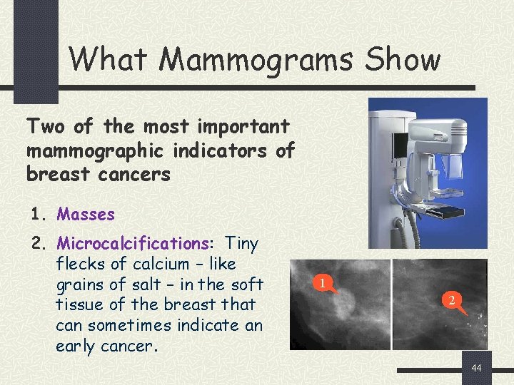 What Mammograms Show Two of the most important mammographic indicators of breast cancers 1.