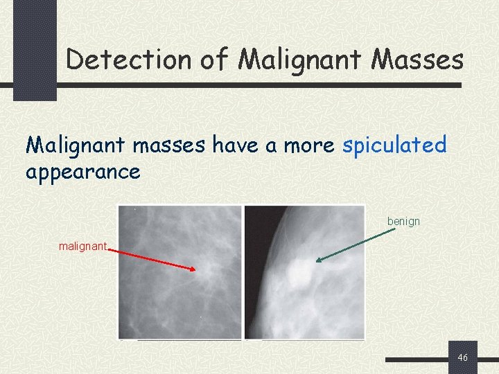 Detection of Malignant Masses Malignant masses have a more spiculated appearance benign malignant 46