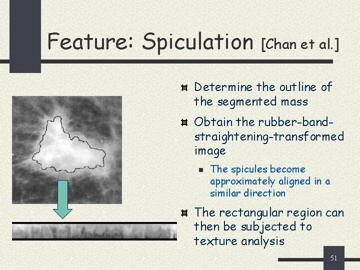 Feature: Spiculation [Chan et al. ] Determine the outline of the segmented mass Obtain