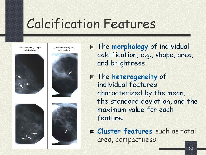 Calcification Features The morphology of individual calcification, e. g. , shape, area, and brightness