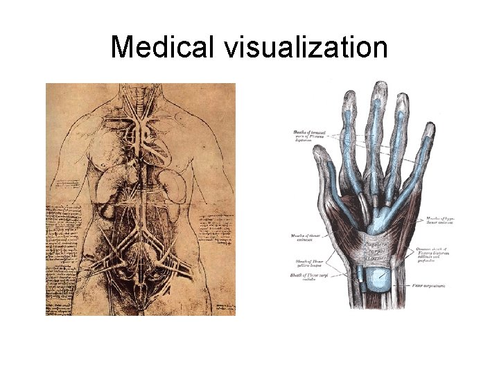Medical visualization 