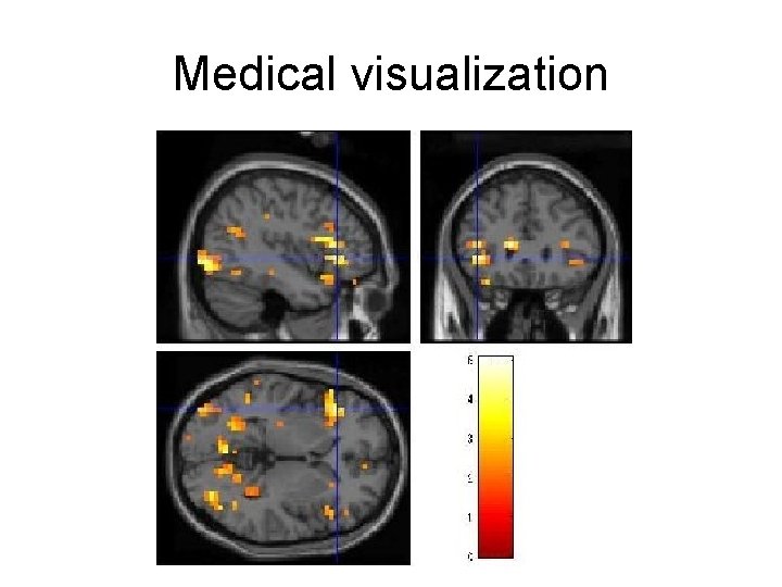Medical visualization 