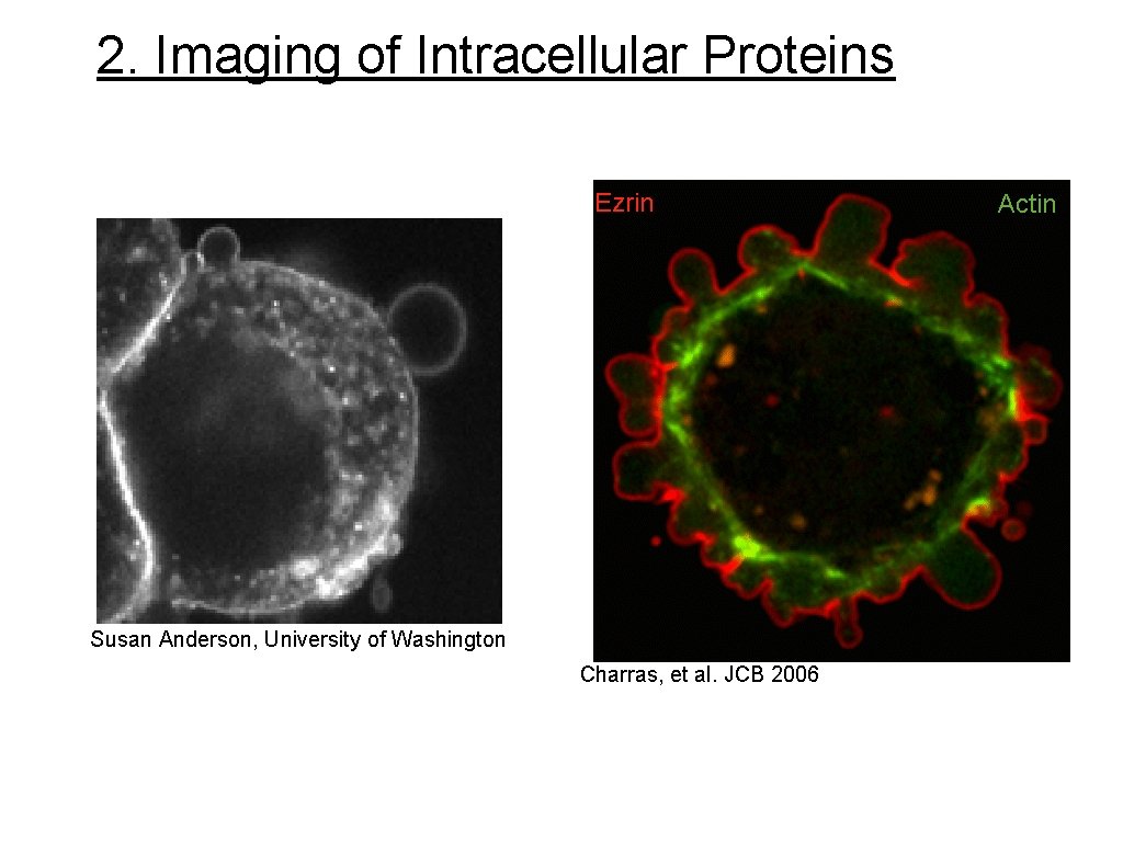 2. Imaging of Intracellular Proteins Ezrin Susan Anderson, University of Washington Charras, et al.