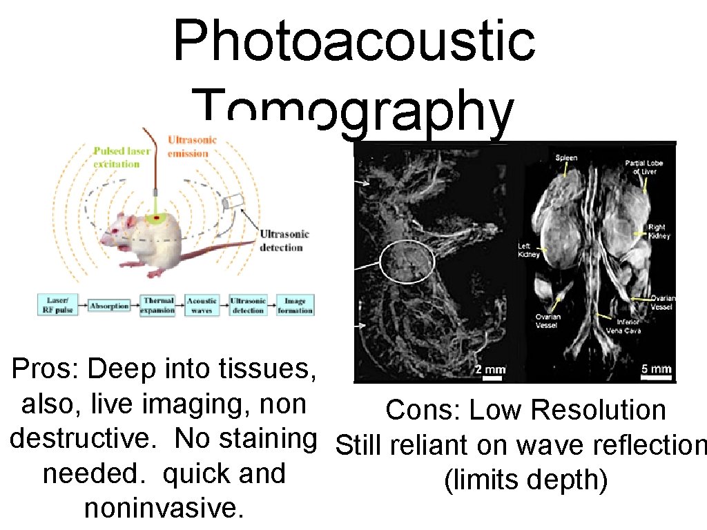 Photoacoustic Tomography Pros: Deep into tissues, also, live imaging, non Cons: Low Resolution destructive.