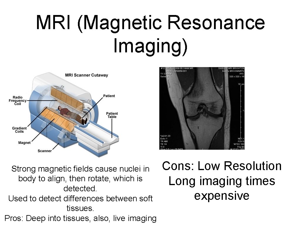 MRI (Magnetic Resonance Imaging) Strong magnetic fields cause nuclei in body to align, then