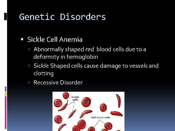 Genetic Disorders Sickle Cell Anemia Abnormally shaped red blood cells due to a deformity