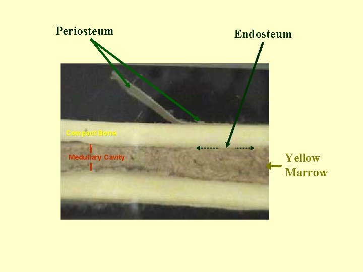 Periosteum Endosteum Compact Bone Medullary Cavity Yellow Marrow 