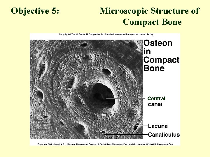 Objective 5: Microscopic Structure of Compact Bone Central 