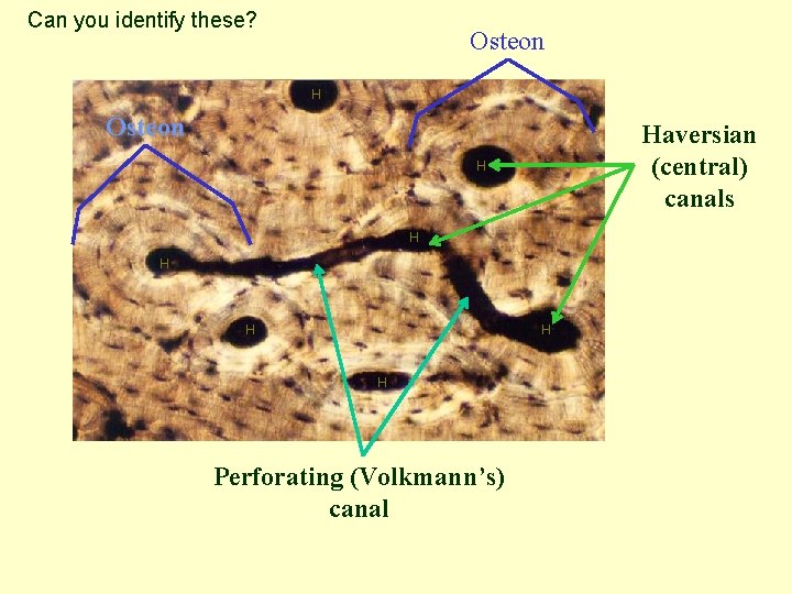 Can you identify these? Osteon Haversian (central) canals H H H Perforating (Volkmann’s) canal
