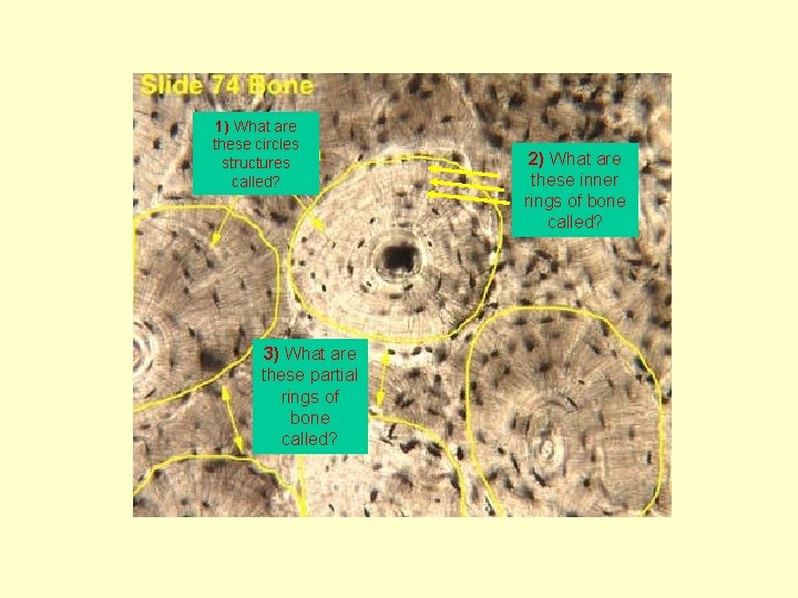 1)(Osteon) What are these circles structures called? 3) What are these partial rings of