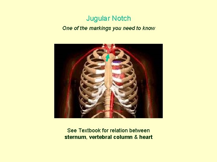 Jugular Notch One of the markings you need to know See Textbook for relation