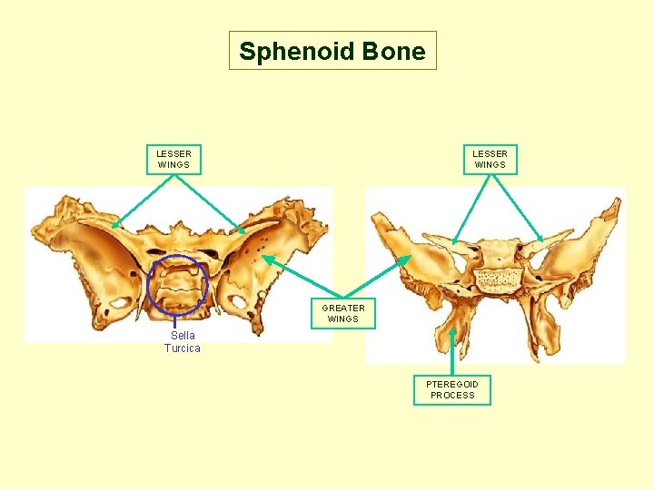 Sphenoid Bone LESSER WINGS GREATER WINGS Sella Turcica PTEREGOID PROCESS 