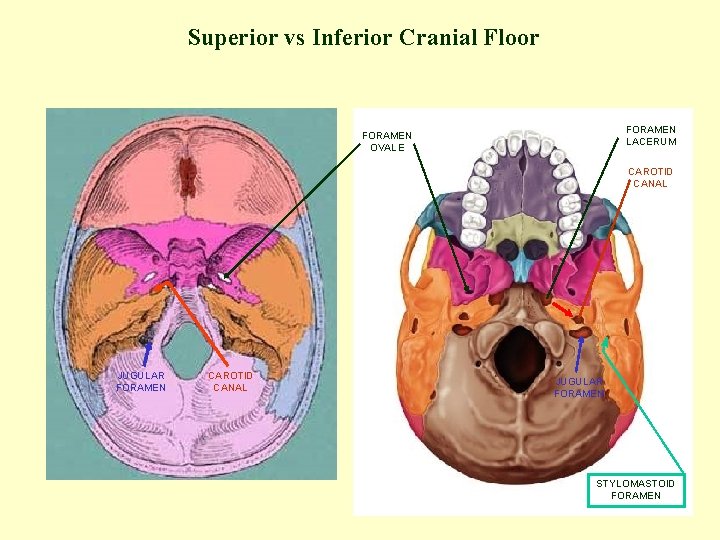Superior vs Inferior Cranial Floor FORAMEN LACERUM FORAMEN OVALE CAROTID CANAL JUGULAR FORAMEN STYLOMASTOID
