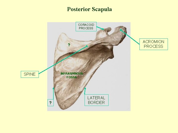 Posterior Scapula CORACOID PROCESS ACROMION PROCESS ? INFRASPINOUS FOSSA SPINE ? LATERAL BORDER 