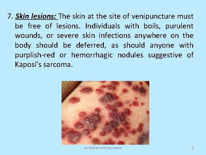 7. Skin lesions: The skin at the site of venipuncture must be free of