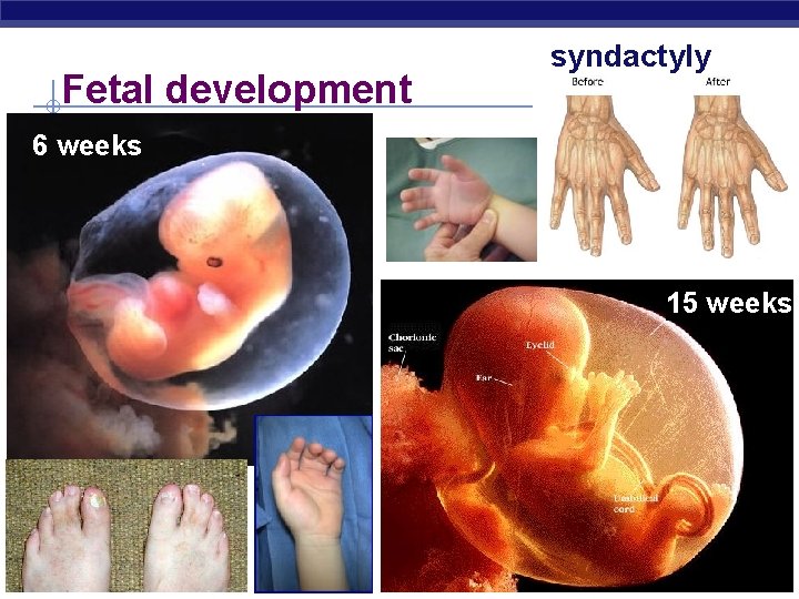 Fetal development syndactyly 6 weeks 15 weeks AP Biology 