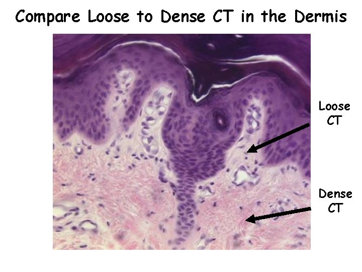 Compare Loose to Dense CT in the Dermis Loose CT Dense CT 