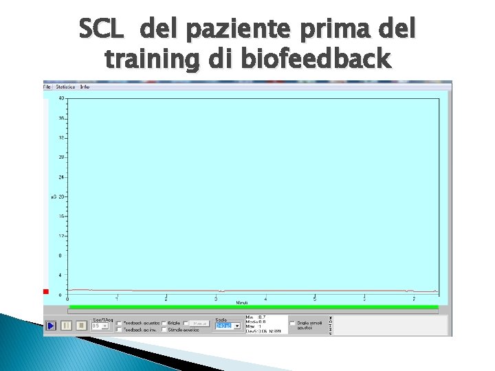 SCL del paziente prima del training di biofeedback 