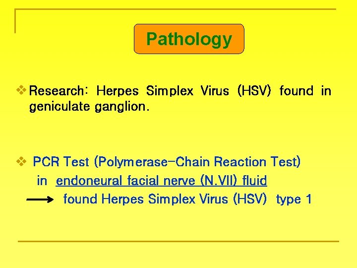 Pathology v Research: Herpes Simplex Virus (HSV) found in geniculate ganglion. v PCR Test