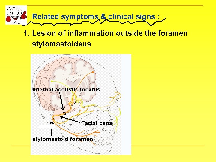 Related symptoms & clinical signs : 1. Lesion of inflammation outside the foramen stylomastoideus