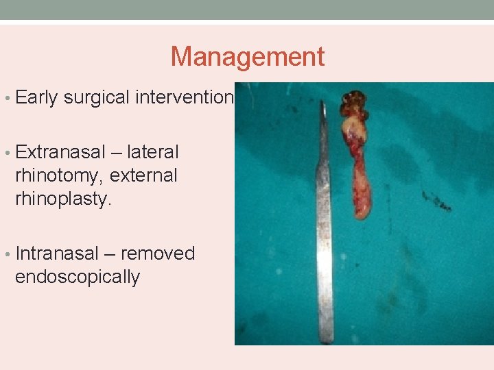 Management • Early surgical intervention • Extranasal – lateral rhinotomy, external rhinoplasty. • Intranasal