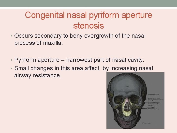 Congenital nasal pyriform aperture stenosis • Occurs secondary to bony overgrowth of the nasal