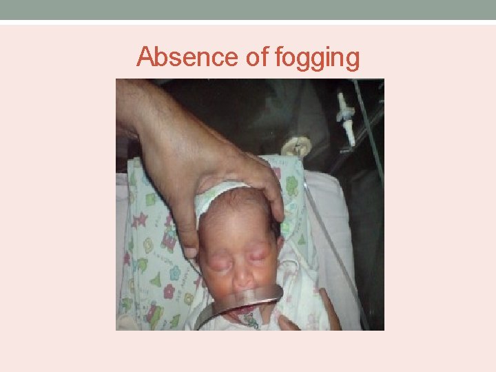 Absence of fogging 