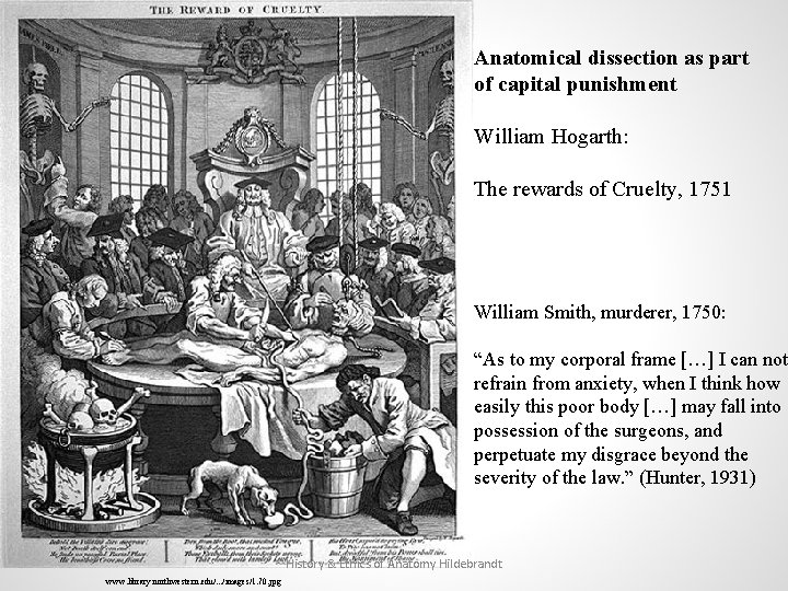 Anatomical dissection as part of capital punishment William Hogarth: The rewards of Cruelty, 1751
