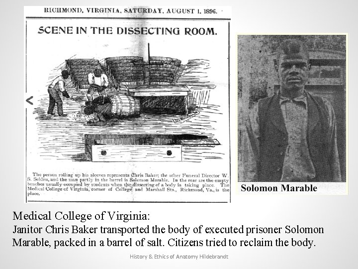Medical College of Virginia: Janitor Chris Baker transported the body of executed prisoner Solomon