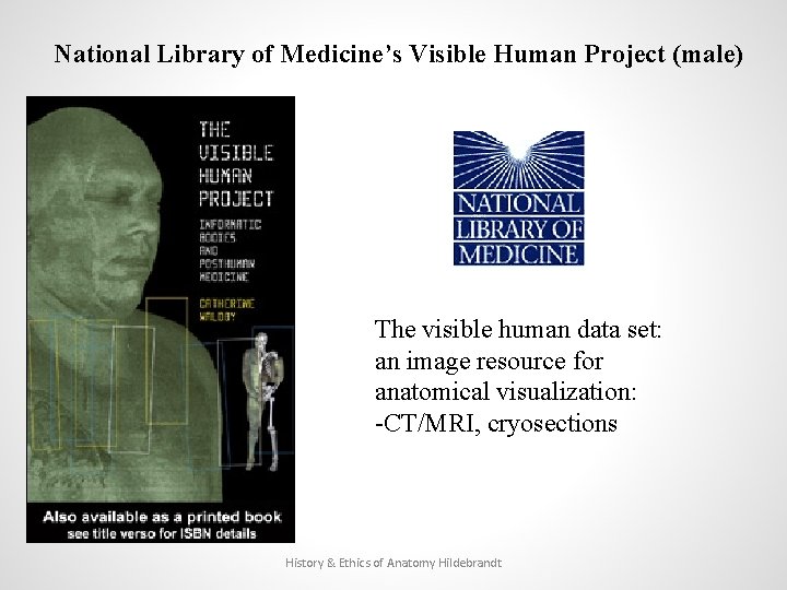 National Library of Medicine’s Visible Human Project (male) The visible human data set: an
