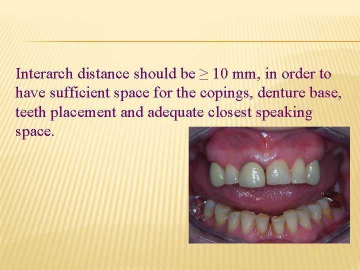 Interarch distance should be ≥ 10 mm, in order to have sufficient space for