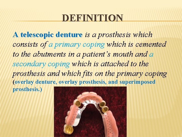 DEFINITION A telescopic denture is a prosthesis which consists of a primary coping which