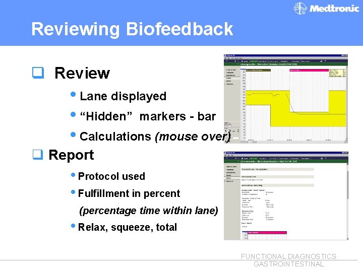 Reviewing Biofeedback q Review i. Lane displayed i“Hidden” markers - bar i. Calculations (mouse