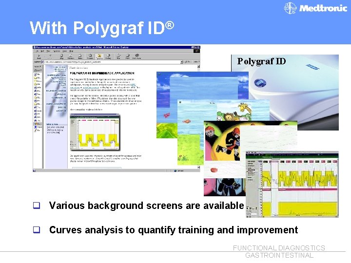 With Polygraf ID® Polygraf ID q Various background screens are available q Curves analysis