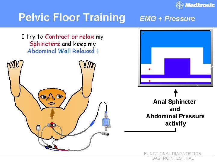 Pelvic Floor Training EMG + Pressure I try to Contract or relax my Sphincters