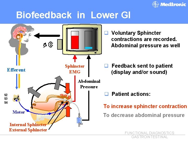 Biofeedback in Lower GI q Voluntary Sphincter contractions are recorded. Abdominal pressure as well