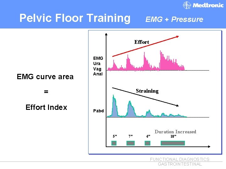 Pelvic Floor Training EMG + Pressure Effort EMG curve area EMG Ura Vag Anal