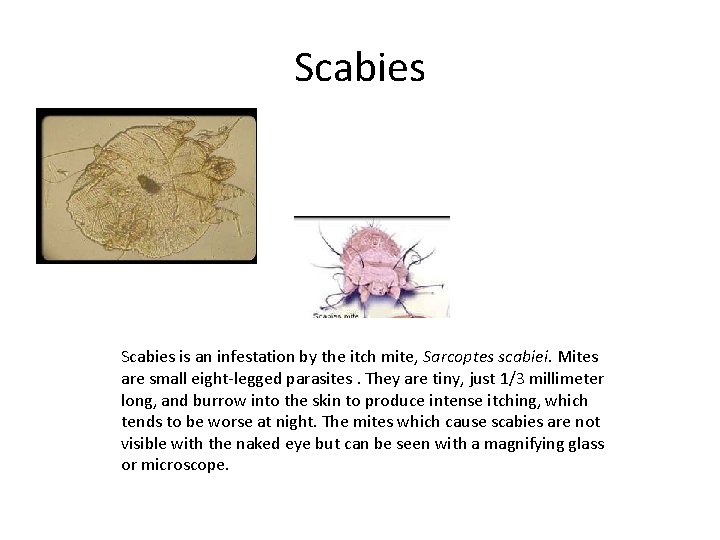 Scabies is an infestation by the itch mite, Sarcoptes scabiei. Mites are small eight-legged