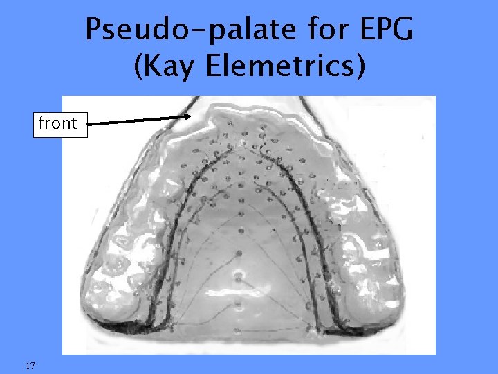 Pseudo-palate for EPG (Kay Elemetrics) front 17 