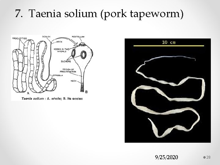 7. Taenia solium (pork tapeworm) 9/25/2020 28 