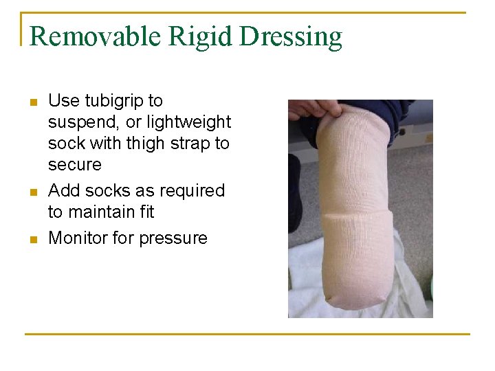 Removable Rigid Dressing n n n Use tubigrip to suspend, or lightweight sock with