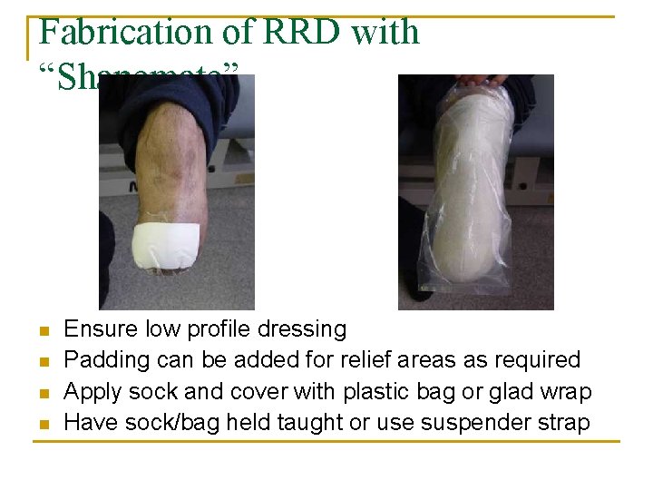 Fabrication of RRD with “Shapemate” n n Ensure low profile dressing Padding can be