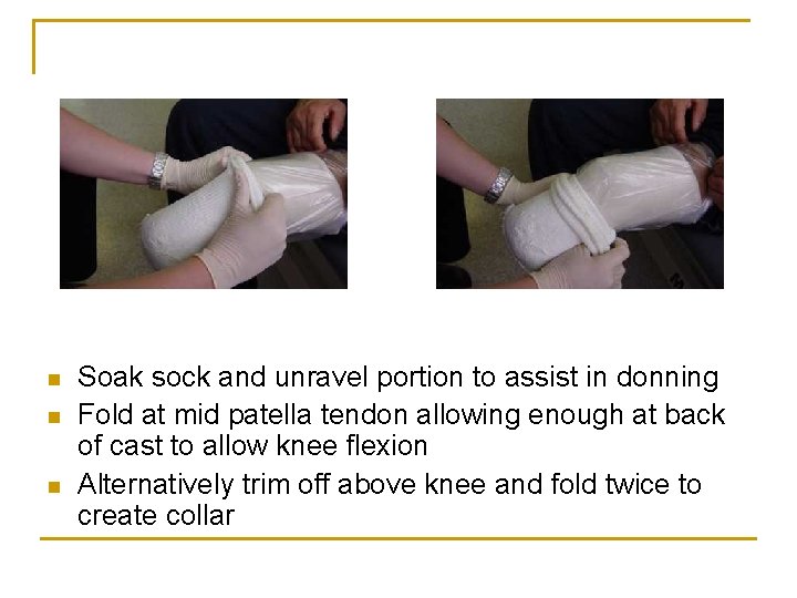 n n n Soak sock and unravel portion to assist in donning Fold at